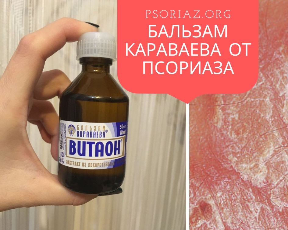 Бальзам Караваева от псориаза