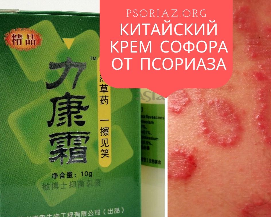 Китайский крем Софора от псориаза