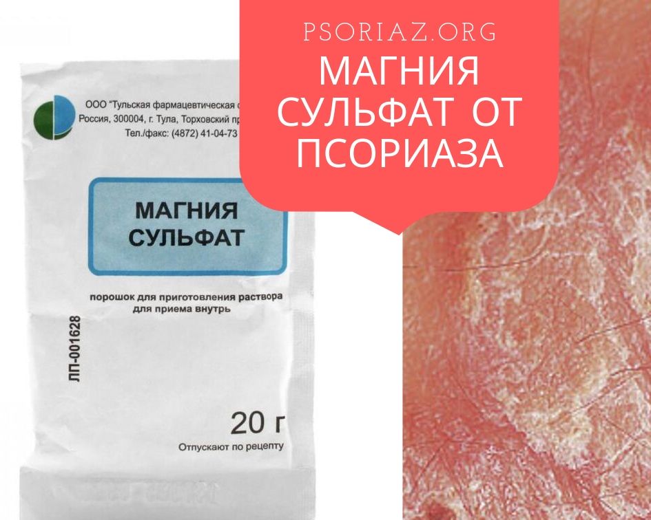 Магния Сульфат от псориаза