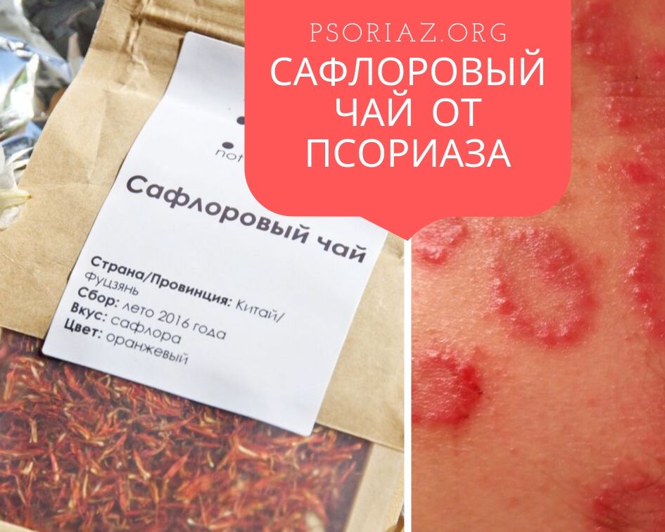 Сафлоровый чай от псориаза